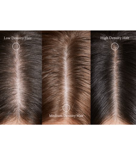 Hair Density: What It Means, How It’s Measured